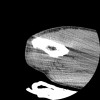 SPORK, NICO - 22.03.1976 - 02.08.2022 - CT obere Extremität - 17:51:17
